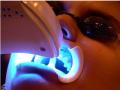 Teeth whitening birmingham cosmetic surgery dentist liposuction specialist logo
