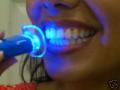 Teeth whitening express Happysmileuk.com image 10