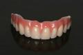 Tooth/Teeth Whitening Clinic Manchester CDental image 3