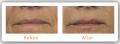 Witney Skin Clinic (Botox Oxford) image 2