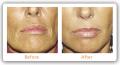 Witney Skin Clinic (Botox Oxford) image 3