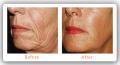 Witney Skin Clinic (Botox Oxford) image 4