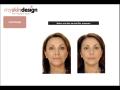 myskindesign - Manchester Botox and dermal fillers by a Consultant Dermatologist image 7