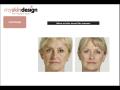myskindesign - Manchester Botox and dermal fillers by a Consultant Dermatologist image 9