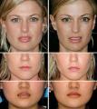 DermaSkin Clinic (Botox Bristol, Fillers Bristol, Botox in Bristol) image 5