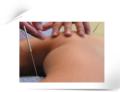 Chisense Acupuncture Health Beauty Clinic image 2