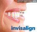 Karia Dental Dentist Welling & Eltham image 7