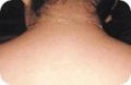 Hair Removal Clinic image 3