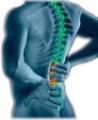 back pain image 4
