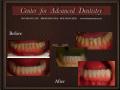 Center for Advanced Dentistry - cosmetic dentist London - best dentist in UK image 4