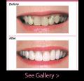 Karia Dental Dentist Welling & Eltham image 6