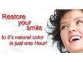 EverWhite Laser Teeth Whitening image 1