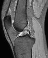 MRI Scan image 5
