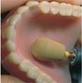 Precision Dental Products Ltd image 4