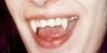 Cosmetic Denture Design, Teeth Whitening and Fangs by Speedy Denture Repairs LTD image 2