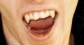 Cosmetic Denture Design, Teeth Whitening and Fangs by Speedy Denture Repairs LTD image 4