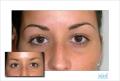 Permanent Makeup London - by Perfect Make-Up 24/7 image 2