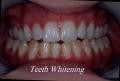 BRIDGE DENTAL & IMPLANT CLINIC image 3
