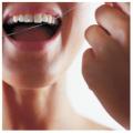 Ghauri Denal Centre- hygiene by dental hygienist London W12 W11 TW5 image 1