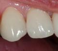 Kingsbridge Dental Laboratory image 5