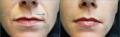 DermaSkin Clinic (Botox Bristol, Fillers Bristol, Botox in Bristol) image 3