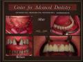 Center for Advanced Dentistry - cosmetic dentist London - best dentist in UK image 6