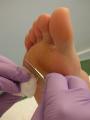 Colinton Mains Podiatry and Chiropody Clinic image 1