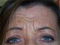 Botox Vistabel Clinic image 2