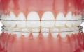 The London Specialist Orthodontic Practice image 5