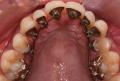 The London Specialist Orthodontic Practice image 4