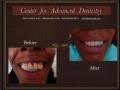 Center for Advanced Dentistry - cosmetic dentist London - best dentist in UK image 5