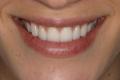 Center for Advanced Dentistry - cosmetic dentist London - best dentist in UK image 3