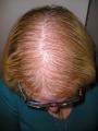 Alopecia Clinic image 6
