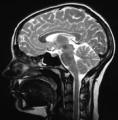 MRI Scan image 6