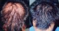 Alopecia Clinic image 2