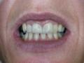 Wrenthorpe Dental Care-Wakefield image 1