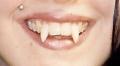 Cosmetic Denture Design, Teeth Whitening and Fangs by Speedy Denture Repairs LTD image 3