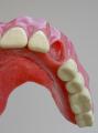 Denture World Mobile (Denture Repairs) image 1