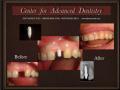 Center for Advanced Dentistry - cosmetic dentist London - best dentist in UK image 7