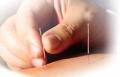 Healing Energy Acupuncture image 1