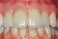 Newbury Smilemakers: Dental Veneers, Clear Adult Braces and Dentist in Berkshire image 5
