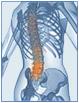 Oxford Osteopathy & Sports Injury Clinic (OSIC) image 4