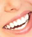 Teeth whitening london cosmetic dentist invisalign braces laser zoom veneers image 1