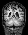 MRI Scan image 2