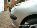 The Dent Clinic - Paintless Dent Repair image 2