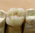 Kingsbridge Dental Laboratory image 2