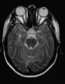 MRI Scan image 4